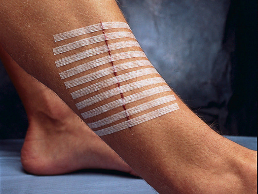 STERI-STRIP 3M - 100 x 6 mm